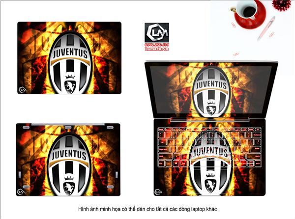Ảnh đại diện sản phẩm Dán skin laptop cầu thủ đội bóng juventus X85