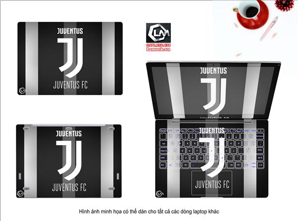 Ảnh đại diện sản phẩm Dán skin laptop cầu thủ đội bóng juventus X81